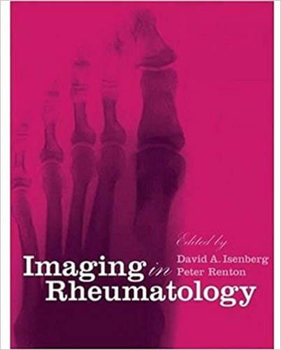 https://pickpdfs.com/imaging-in-rheumatology-book-free-pdf-download-latest-edition/