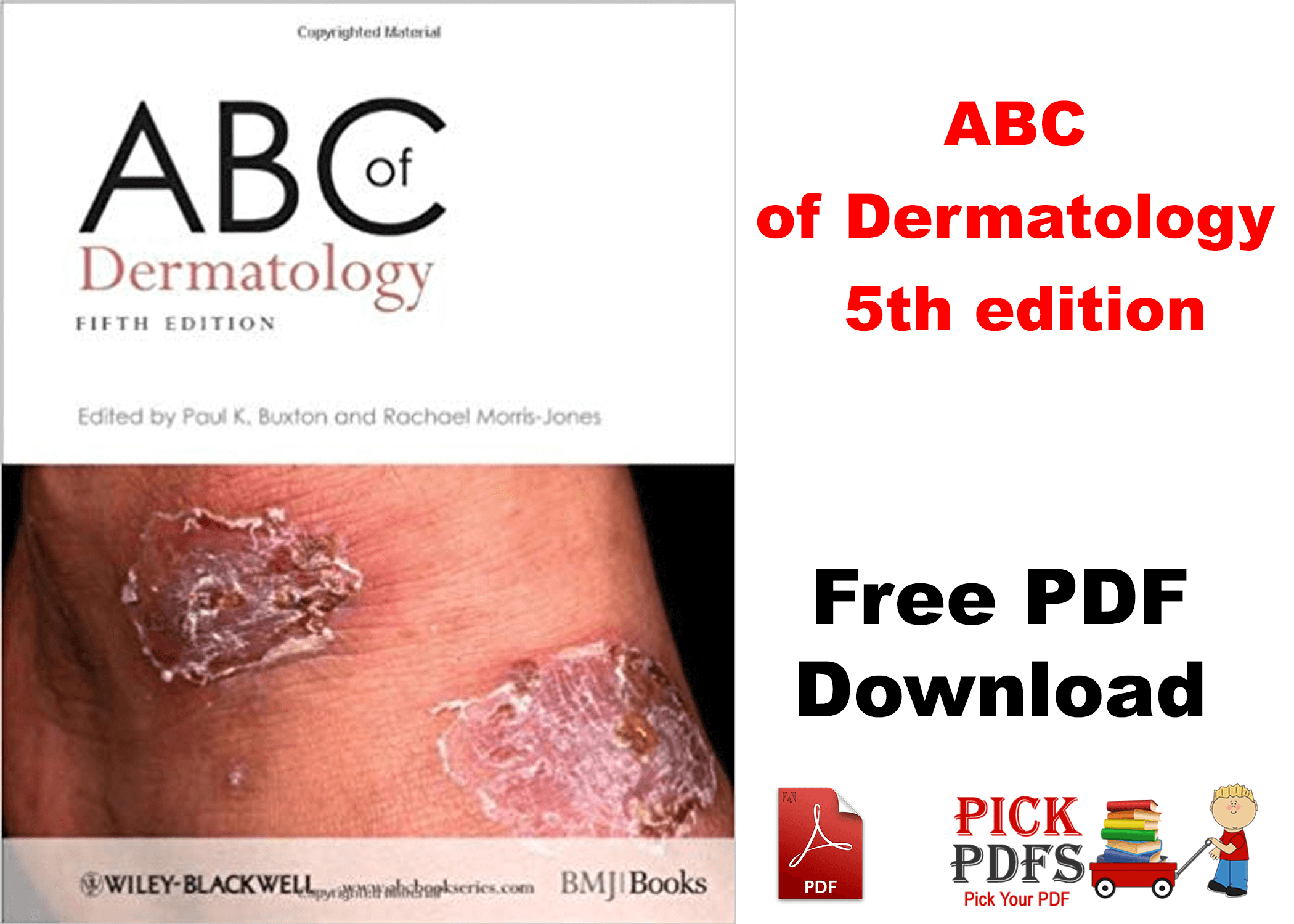 https://pickpdfs.com/abc-of-wound-healing-pdf-free-pdf-pickpdfs-medical-books/