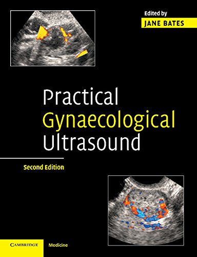 https://pickpdfs.com/practical-gynaecological-ultrasound-2nd-edition-pdf-free-pdf-pickpdfs-medical-books/