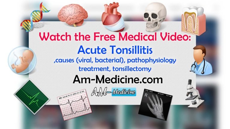 Acute Tonsillitis – causes (viral, bacterial), pathophysiology, treatment, tonsillectomy [Video]