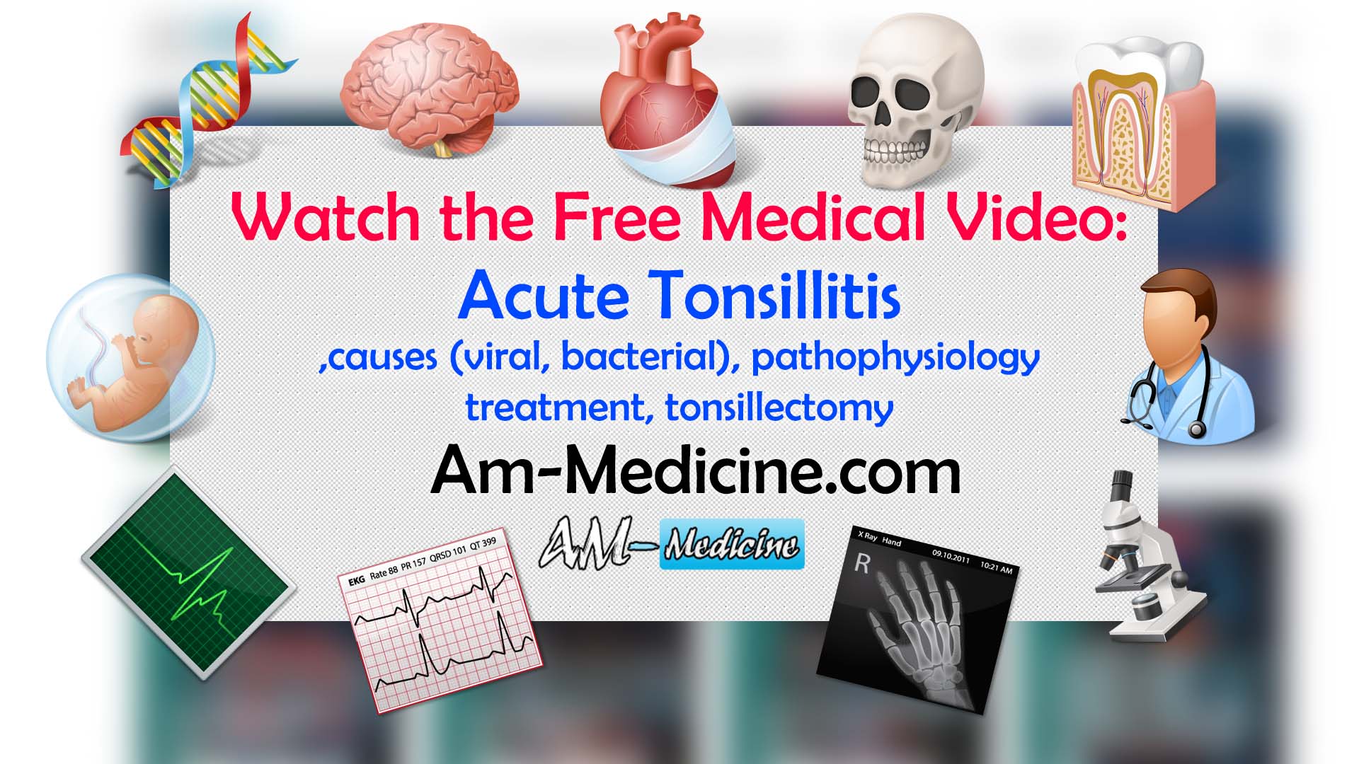 https://pickpdfs.com/acute-tonsillitis-causes-viral-bacterial-pathophysiology-treatment-tonsillectomy-video/