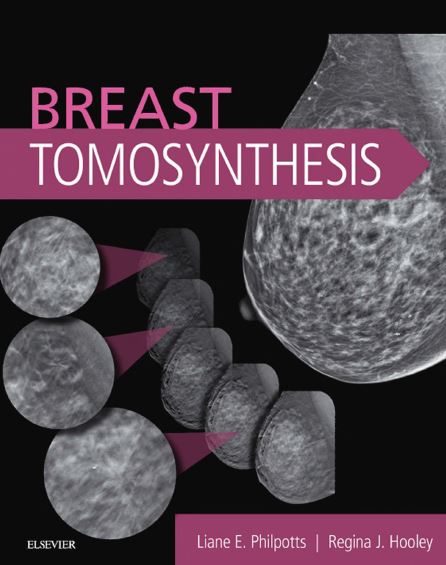 https://pickpdfs.com/breast-tomosynthesis-1st-edition-pdf-download/