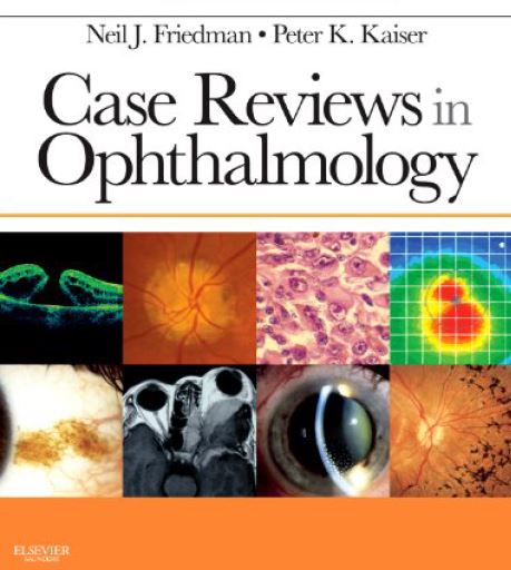 https://pickpdfs.com/case-reviews-in-ophthalmology-1st-edition-pdf/