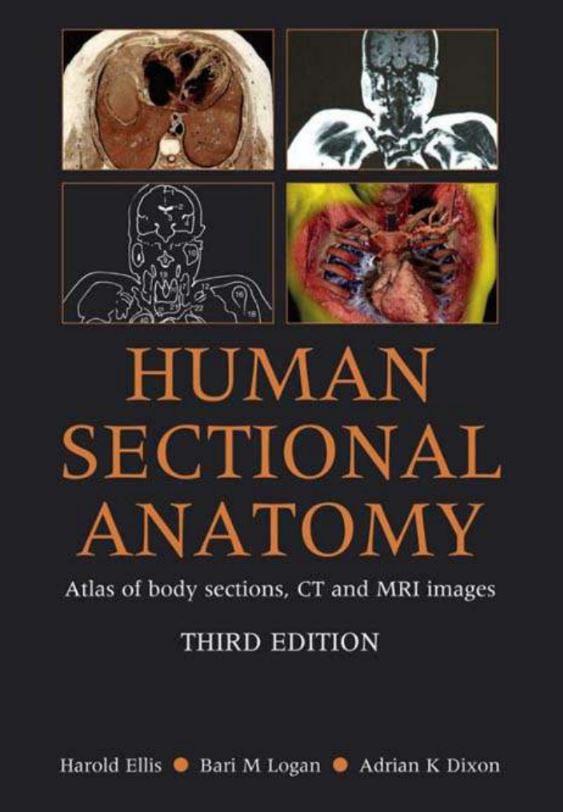 https://pickpdfs.com/human-sectional-anatomy-3rd-edition-pdf/