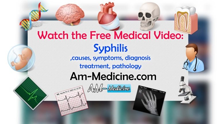 causes, symptoms, diagnosis, treatment, pathology [Video]